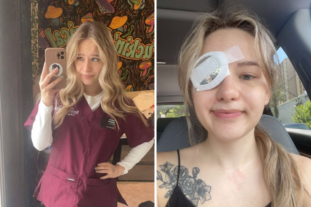 Doctors Said My Eyes Were Just Dry—Now I Live With a Devastating ...