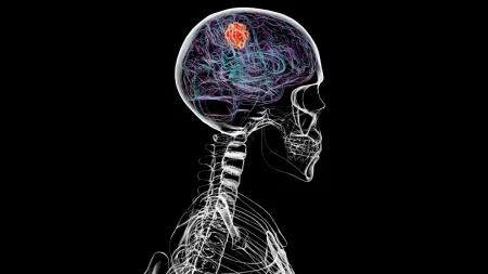 Brain cancer can dissolve parts of the skull