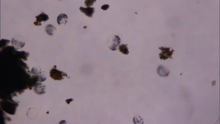 This giant microbe organizes its DNA in a surprising way