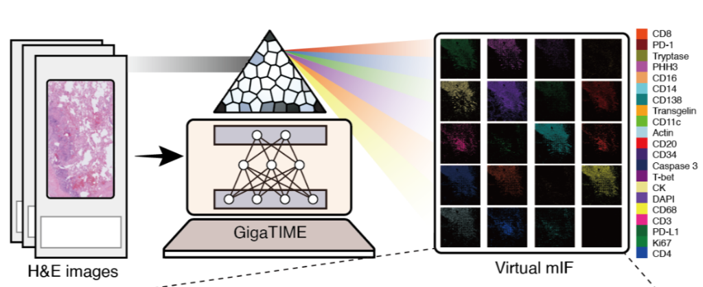 Microsoft, Providence create AI that unlocks tumor insights