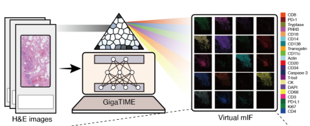 Microsoft, Providence create AI that unlocks tumor insights