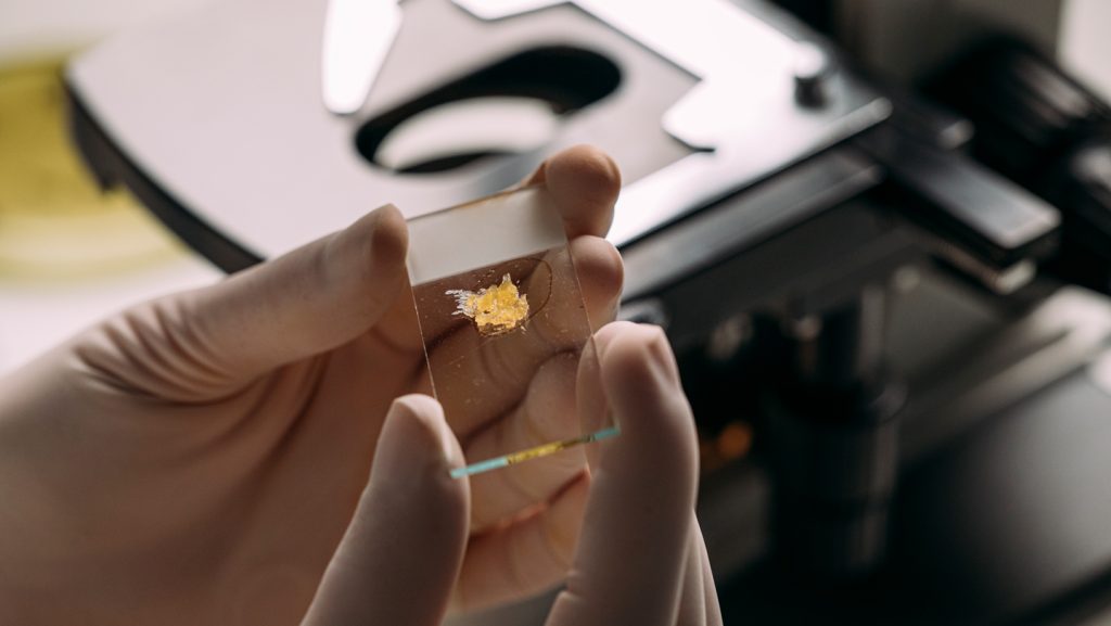 It masquerades as malignant. But this bone-covered tumor is benign