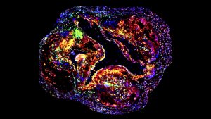 Sleep and exercise may dampen genetic drivers of heart disease