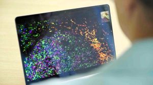 AI turns up a promising finding in cancer data that researchers hadn’t noticed for years