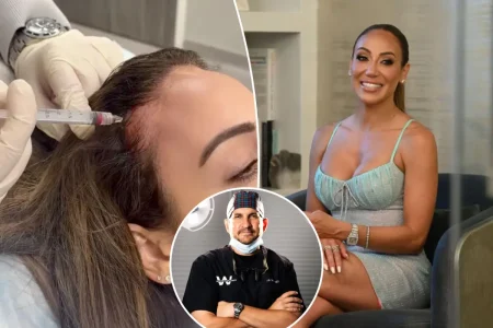 I restored Melissa Gorga’s thinning hairline — here’s exactly how I helped grow her locks back